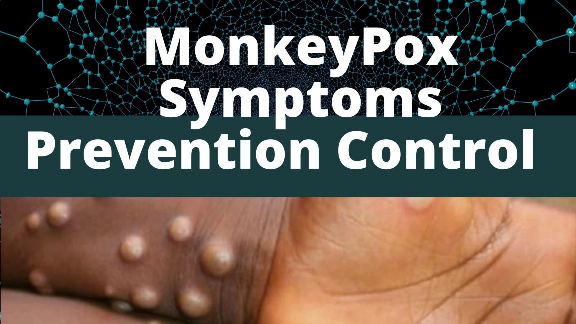 MonkeyPox Disease: Symptoms Prevention And Treatment - Dr Asma Jabeen