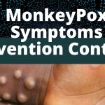 Monkeypox Disease