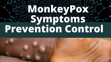 Monkeypox Disease